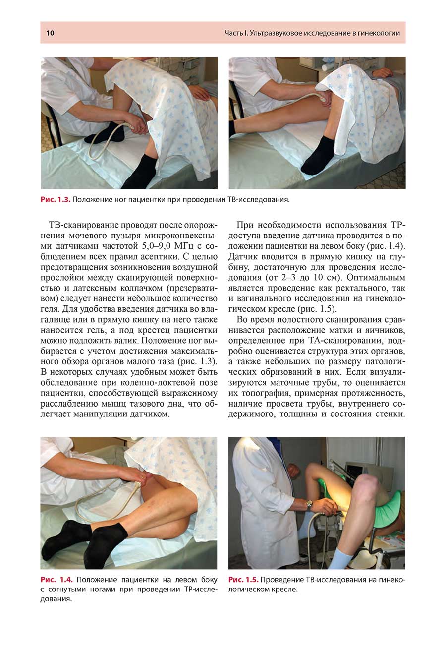 Рис. 1.4. Положение пациентки на левом боку с согнутыми ногами при проведении ТР-исследования.